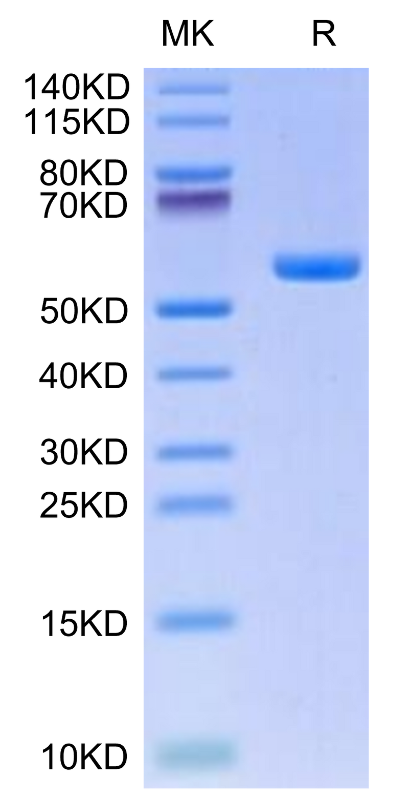 Human HLA-A*11:01&B2M&KRAS G12V (VVGAVGVGK) Monomer on Tris-Bis PAGE under reduced condition. The purity is greater than 95%.Recombinant Human HLA-A*11:01&B2M&KRAS G12V (VVGAVGVGK) Monomer Protein