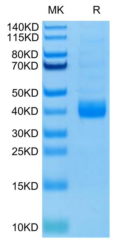 Biotinylated Human NKp46 (Primary Amine Labeling) on Tris-Bis PAGE under reduced condition. The purity is greater than 95%.