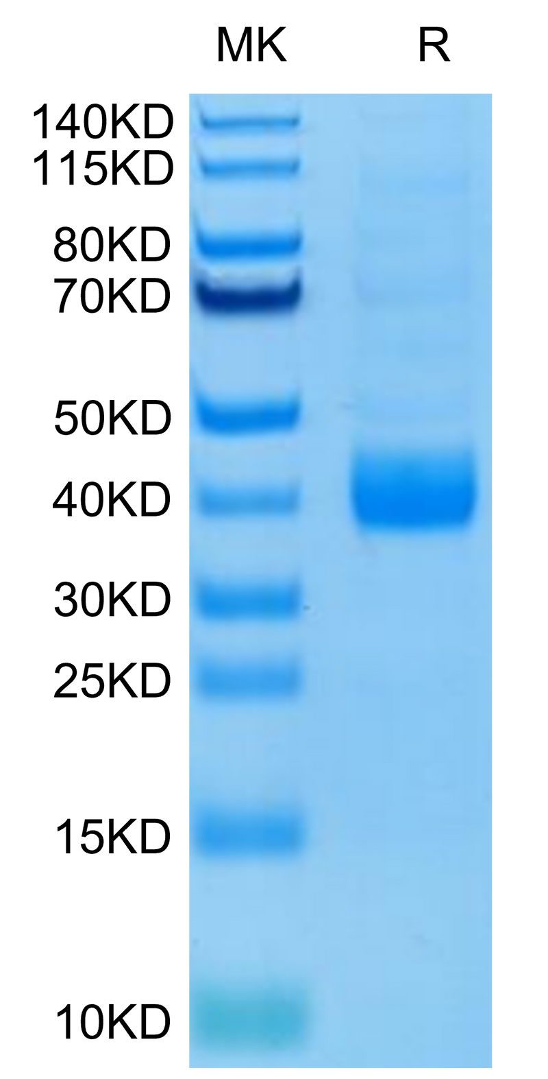 Biotinylated Human NKp46 (Primary Amine Labeling) on Tris-Bis PAGE under reduced condition. The purity is greater than 95%.Biotinylated Human NKp46/NCR1/CD335 Protein (Primary Amine Labeling), Active