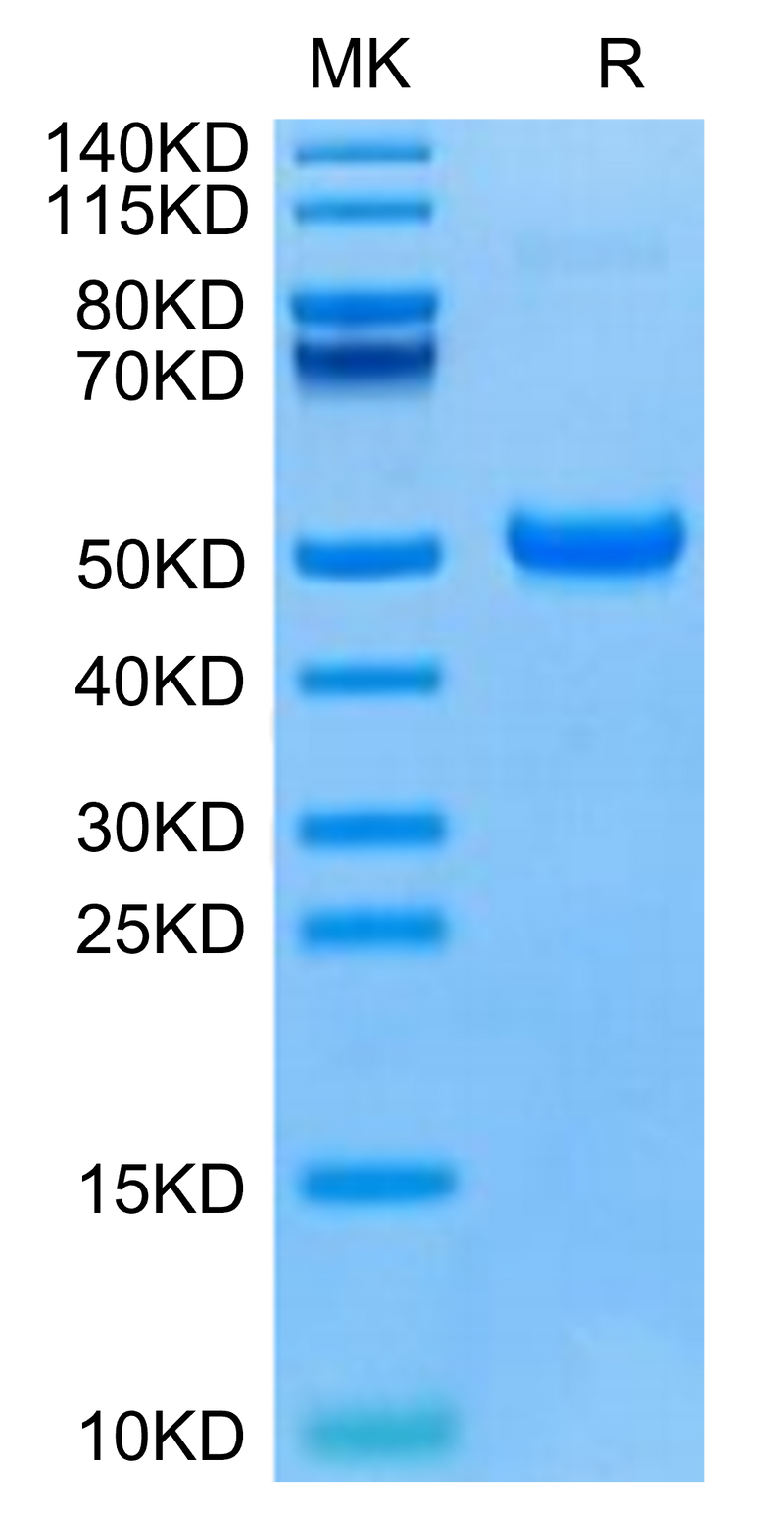 Human DKK1 C terminal Domain on Tris-Bis PAGE under reduced condition. The purity is greater than 95%.Recombinant Human DKK1 C terminal Domain Protein, Active