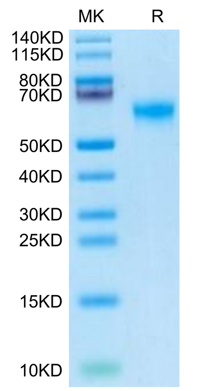 Human DDR2 on Tris-Bis PAGE under reduced condition. The purity is greater than 95%.Recombinant Human DDR2 Protein