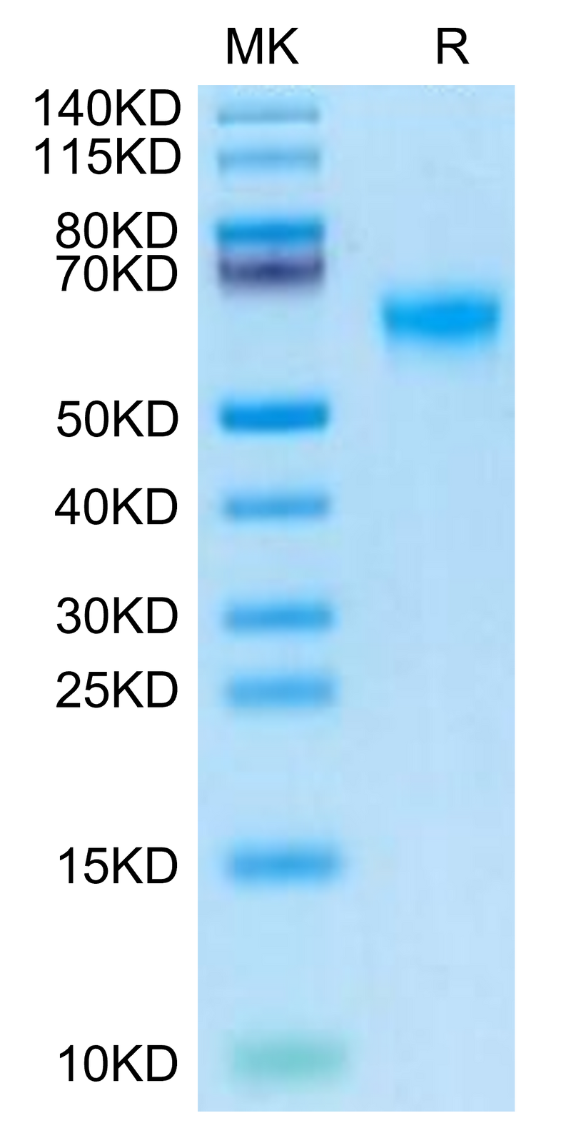 Human DDR2 on Tris-Bis PAGE under reduced condition. The purity is greater than 95%.Recombinant Human DDR2 Protein