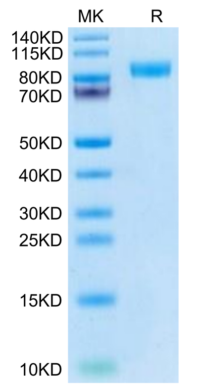 Cynomolgus Her2 on Tris-Bis PAGE under reduced condition. The purity is greater than 95%.Recombinant Cynomolgus Her2/ErbB2 Protein, Active