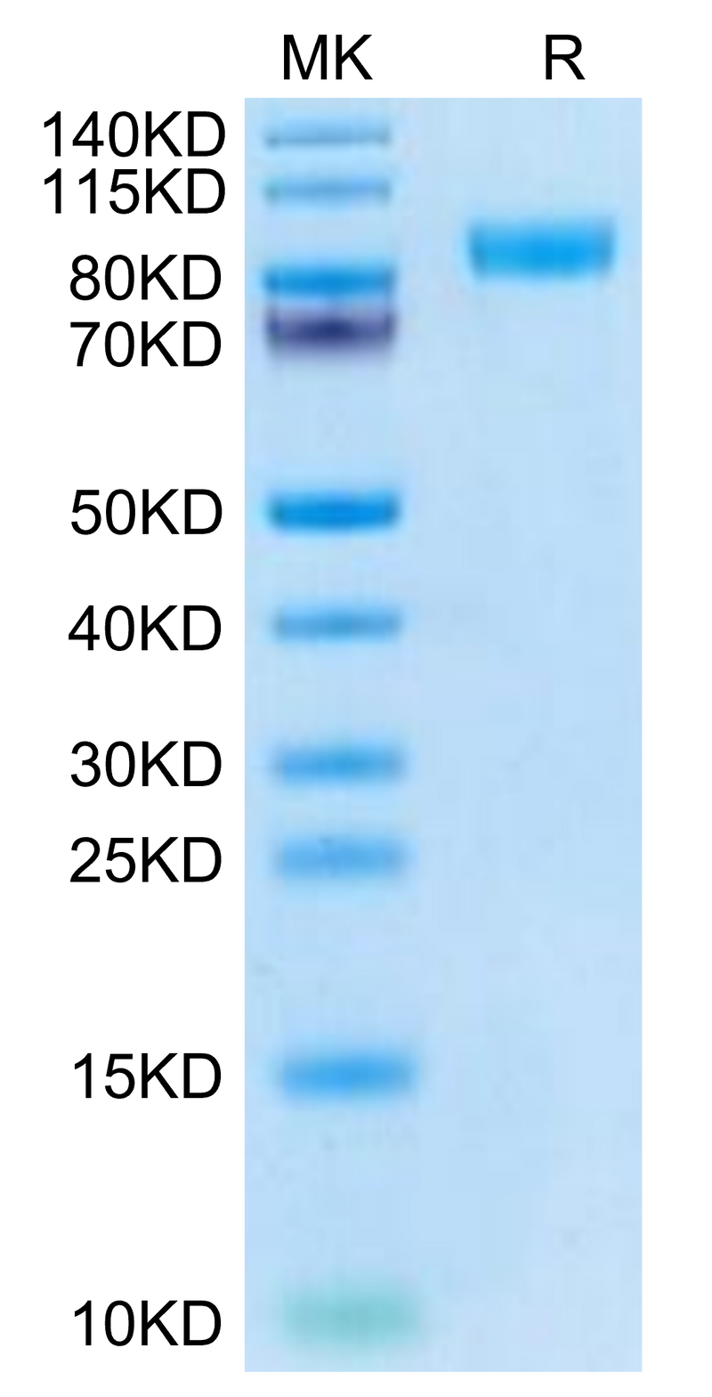 Cynomolgus Her2 on Tris-Bis PAGE under reduced condition. The purity is greater than 95%.Recombinant Cynomolgus Her2/ErbB2 Protein, Active