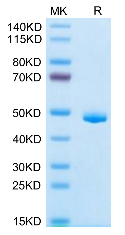 Human CLEC7A on Tris-Bis PAGE under reduced condition. The purity is greater than 95%.Recombinant Human CLEC7A Protein