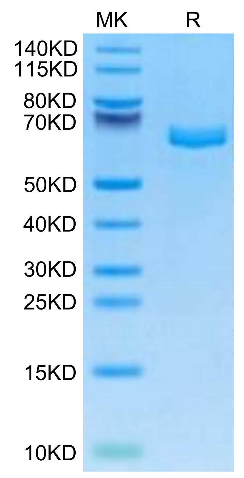 Mouse EPHA2 on Tris-Bis PAGE under reduced condition. The purity is greater than 95%.Recombinant Mouse EPHA2 Protein