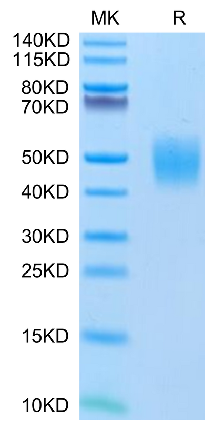 Human FGFR2 beta (IIIc) on Tris-Bis PAGE under reduced conditions. The purity is greater than 95%.Recombinant Human FGFR2 beta (IIIc) Protein, Active