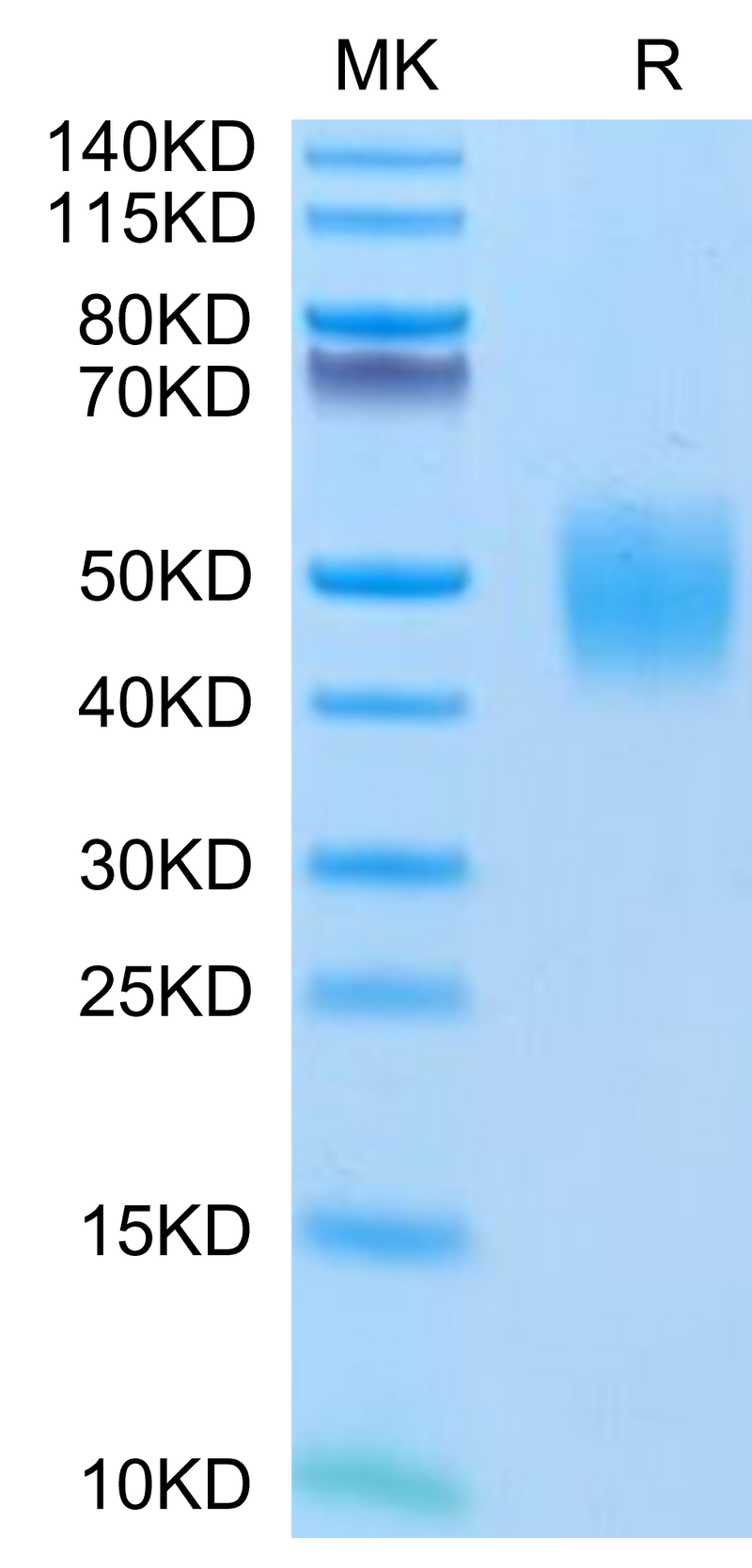 Human FGFR2 beta (IIIc) on Tris-Bis PAGE under reduced conditions. The purity is greater than 95%.Recombinant Human FGFR2 beta (IIIc) Protein, Active