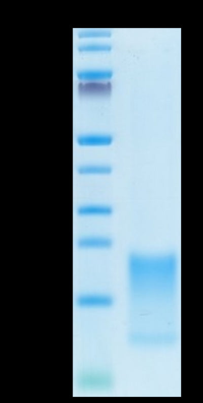Cynomolgus BAFFR on Tris-Bis PAGE under reduced condition. The purity is greater than 95%.Recombinant Cynomolgus BAFFR/TNFRSF13C Protein, Active