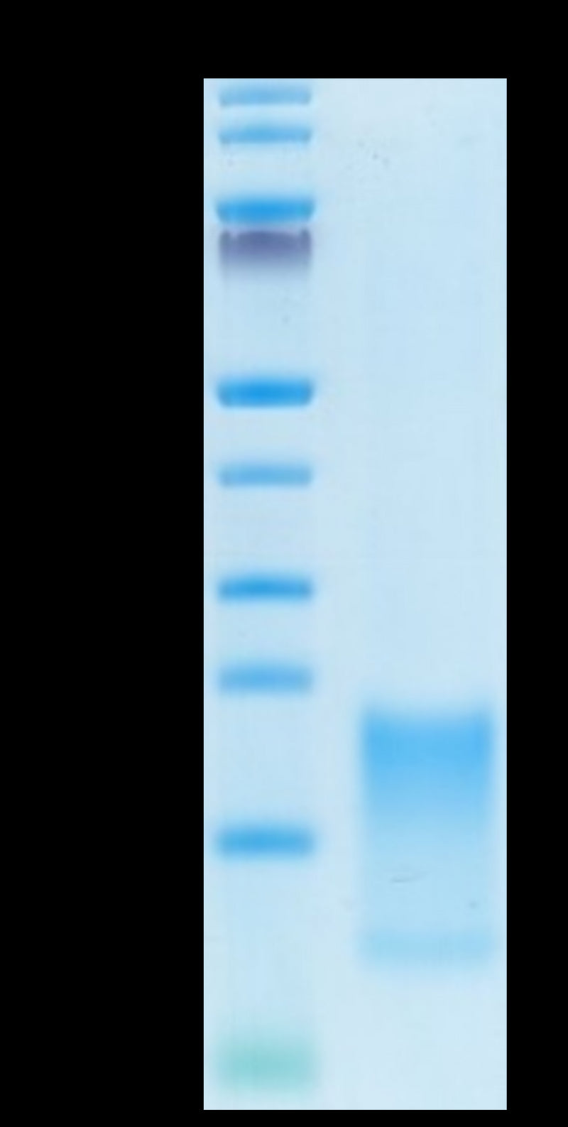 Cynomolgus BAFFR on Tris-Bis PAGE under reduced condition. The purity is greater than 95%.Recombinant Cynomolgus BAFFR/TNFRSF13C Protein, Active