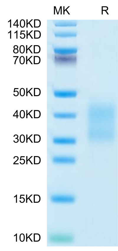 Mouse CD79B on Tris-Bis PAGE under reduced condition. The purity is greater than 95%.Recombinant Mouse CD79B Protein