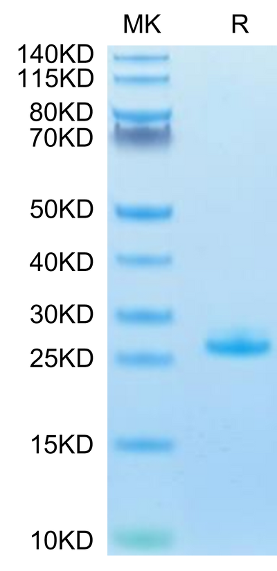 Human FGF21 on Tris-Bis PAGE under reduced condition. The purity is greater than 95%.Recombinant Human FGF21 Protein, Active