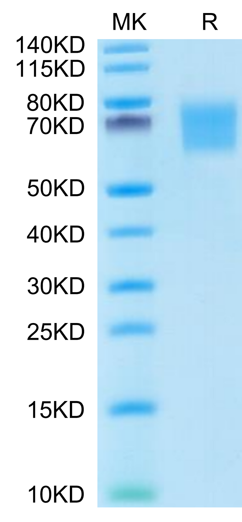 Human FGFR2 alpha (IIIb) on Tris-Bis PAGE under reduced conditions. The purity is greater than 95%.Recombinant Human FGFR2 alpha (IIIb) Protein, Active