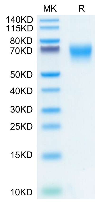 Human FGFR2 alpha (IIIc) on Tris-Bis PAGE under reduced conditions. The purity is greater than 95%.Recombinant Human FGFR2 alpha (IIIc) Protein