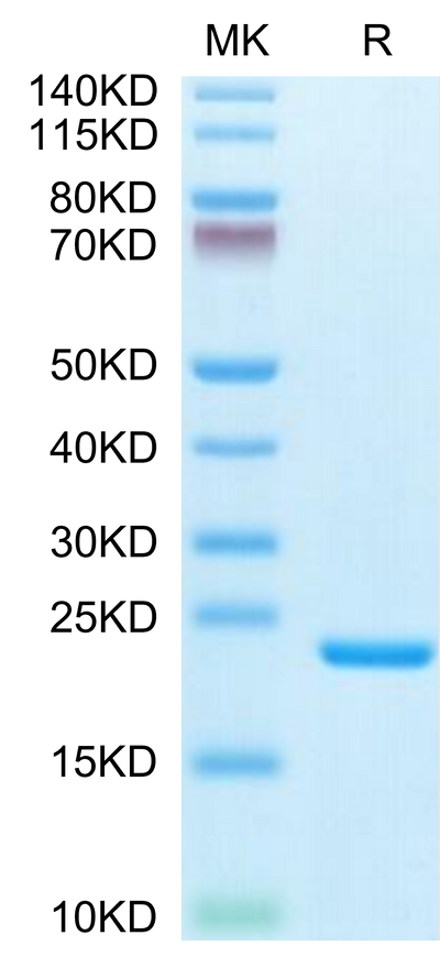 Biotinylated Human IL-1 Beta on Tris-Bis PAGE under reduced condition. The purity is greater than 95%.Biotinylated Human IL-1 Beta/IL-1F2 Protein, Active