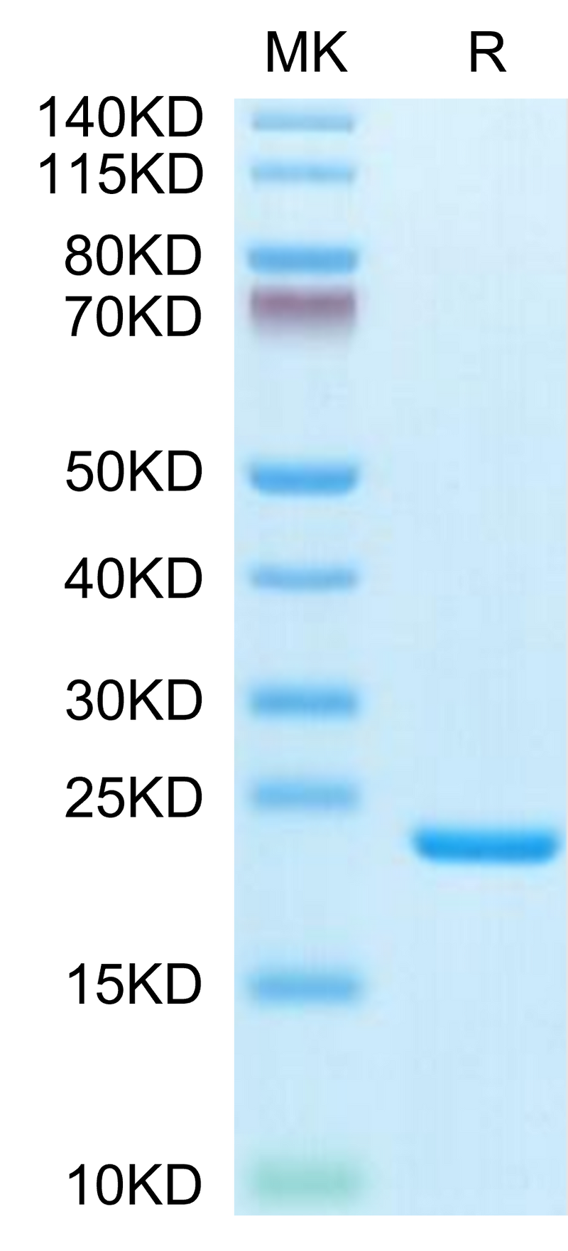 Biotinylated Human IL-1 Beta on Tris-Bis PAGE under reduced condition. The purity is greater than 95%.Biotinylated Human IL-1 Beta/IL-1F2 Protein, Active