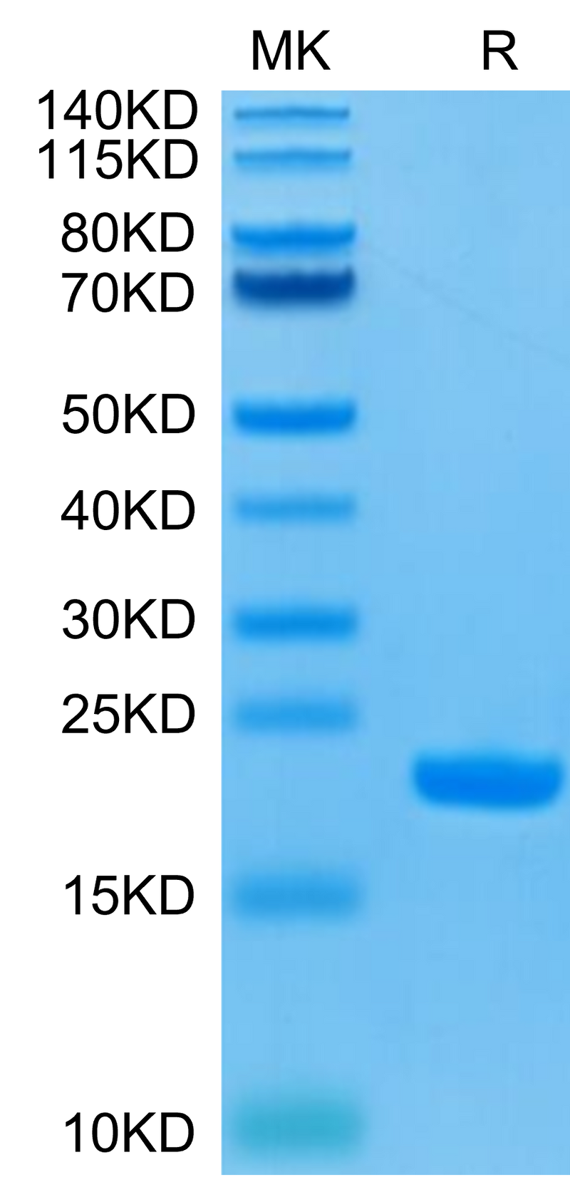 Human IL-1 Beta on Tris-Bis PAGE under reduced condition. The purity is greater than 95%.Recombinant Human IL-1 Beta/IL-1F2 Protein, Active