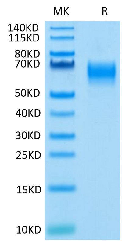 Human IL-1 Rrp2 on Tris-Bis PAGE under reduced condition. The purity is greater than 95%.Recombinant Human IL-1 Rrp2/IL-1 R6 Protein, Active