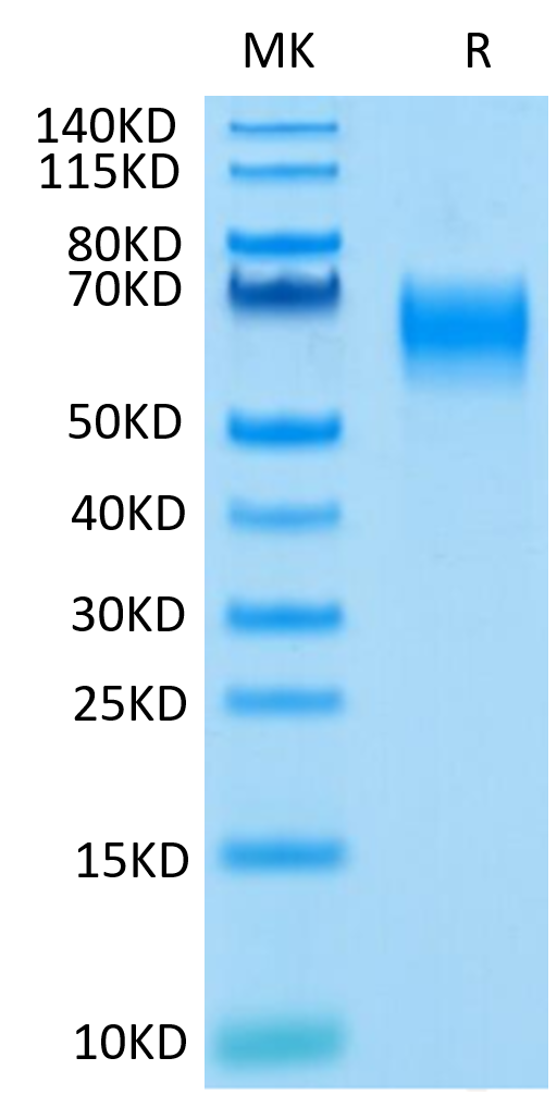 Human IL-1 Rrp2 on Tris-Bis PAGE under reduced condition. The purity is greater than 95%.Recombinant Human IL-1 Rrp2/IL-1 R6 Protein, Active