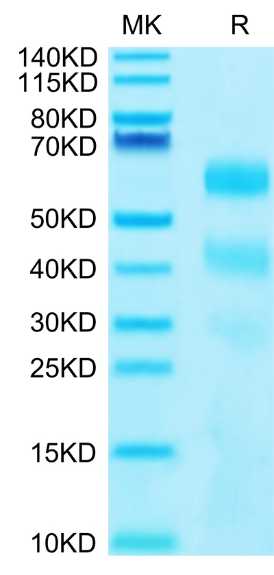 Human KIR3DL2 on Tris-Bis PAGE under reduced conditions. The purity is greater than 95%.Recombinant Human KIR3DL2 Protein, Active