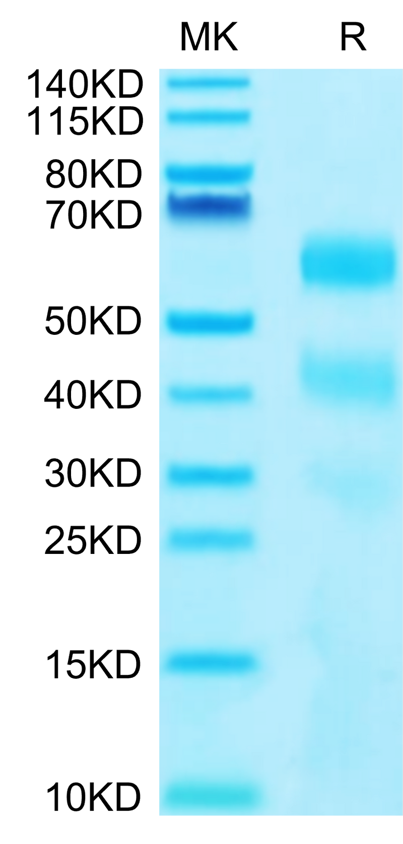 Human KIR3DL2 on Tris-Bis PAGE under reduced conditions. The purity is greater than 95%.Recombinant Human KIR3DL2 Protein, Active
