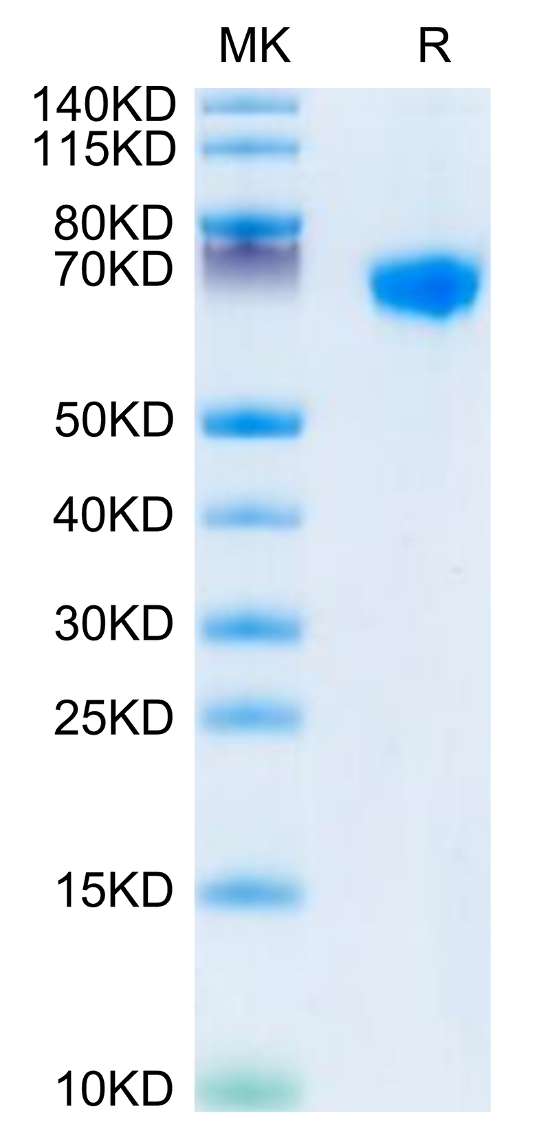 Rhesus macaque LILRB1 on Tris-Bis PAGE under reduced conditions. The purity is greater than 95%.Recombinant Rhesus macaque LILRB1/CD85j/ILT2 Protein, Active