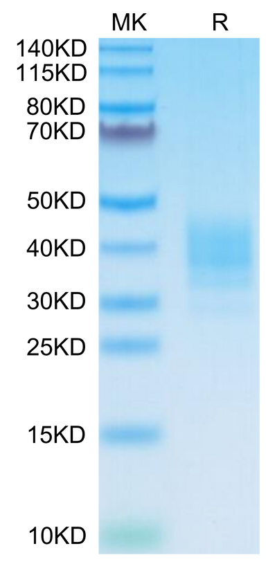 Mouse SLAMF7 on Tris-Bis PAGE under reduced condition. The purity is greater than 95%.Recombinant Mouse SLAMF7/CRACC/CD319 Protein