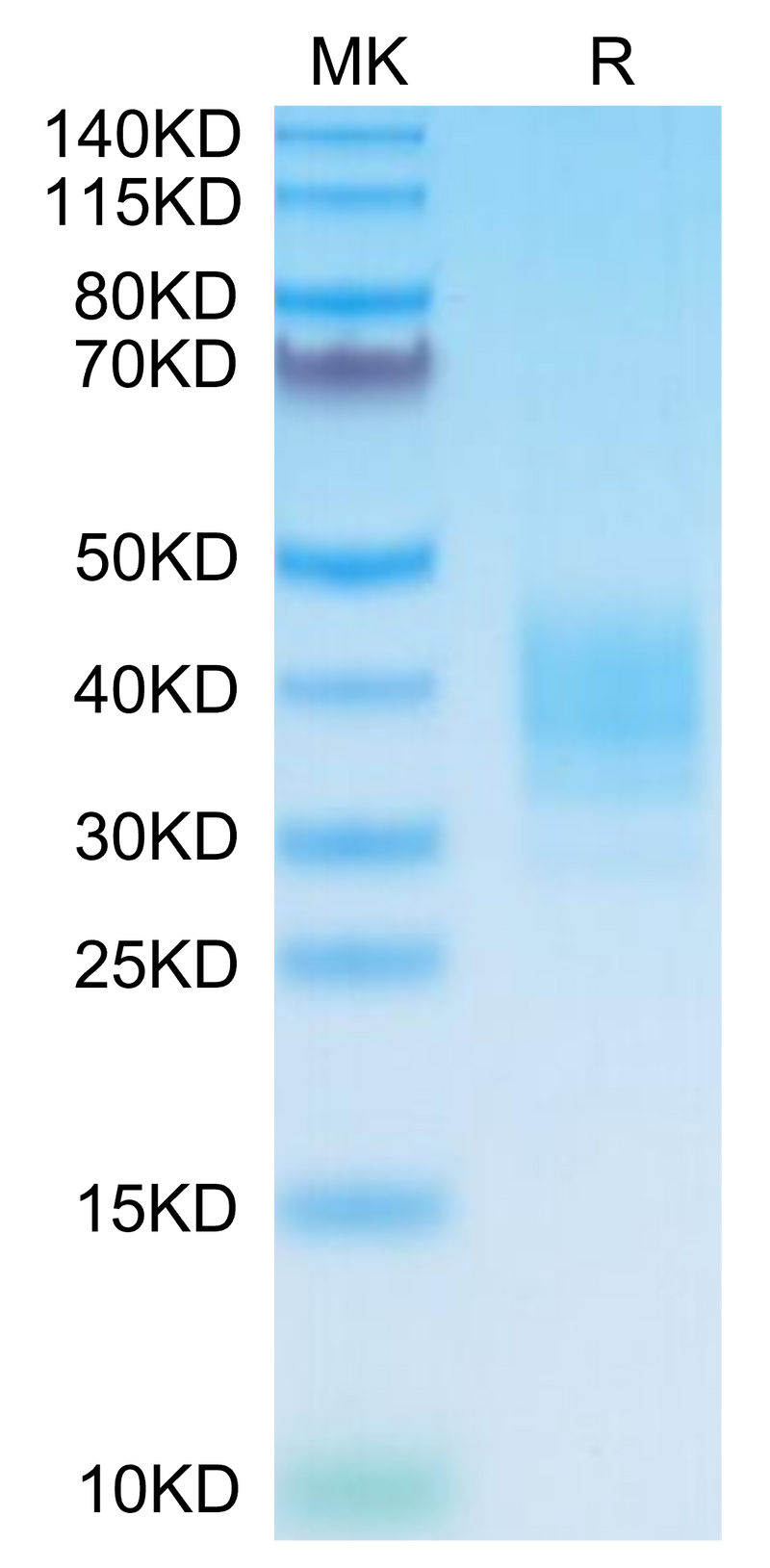 Mouse SLAMF7 on Tris-Bis PAGE under reduced condition. The purity is greater than 95%.Recombinant Mouse SLAMF7/CRACC/CD319 Protein