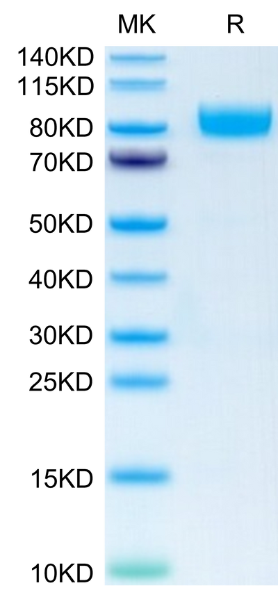 Human IL-1 Rrp2 on Tris-Bis PAGE under reduced condition. The purity is greater than 95%.Recombinant Human IL-1 Rrp2/IL-1 R6 Protein, Active