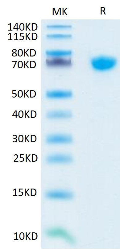 Human TNFSF15 Trimer on Tris-Bis PAGE under reduced condition. The purity is greater than 95%.Recombinant Human TNFSF15 Trimer Protein, Active