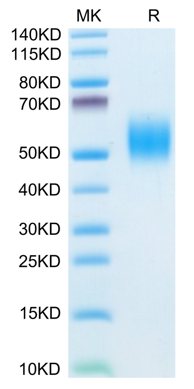 Mouse FGFR2 beta (IIIb) on Tris-Bis PAGE under reduced conditions. The purity is greater than 95%.Recombinant Mouse FGFR2 beta (IIIb) Protein