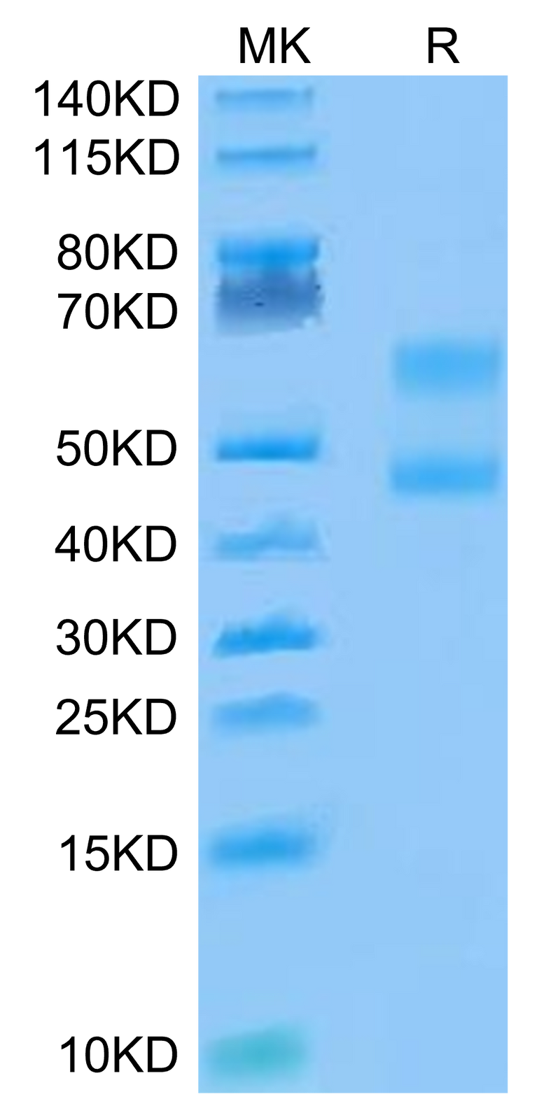 Biotinylated Cynomolgus CD3E&CD3D on Tris-Bis PAGE under reduced conditions. The purity is greater than 95%.Biotinylated Cynomolgus CD3E&CD3D/CD3 epsilon&CD3 delta Protein (Primary Amine Labeling), Active