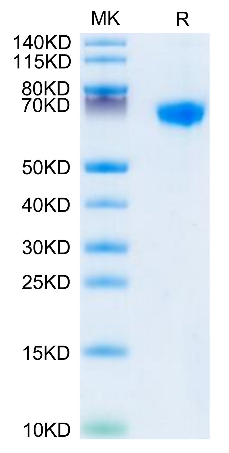 Rhesus macaque LILRB1 on Tris-Bis PAGE under reduced condition. The purity is greater than 95%.Recombinant Rhesus macaque LILRB1/CD85j/ILT2 Protein, Active