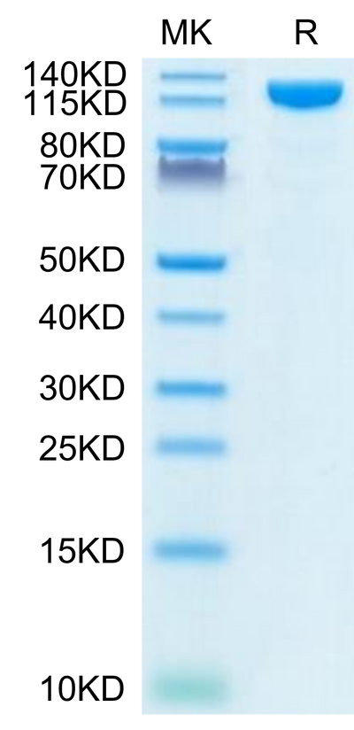 Human ACE2 on Tris-Bis PAGE under reduced condition. The purity is greater than 95%.Recombinant Human ACE2/ACEH Protein, Active