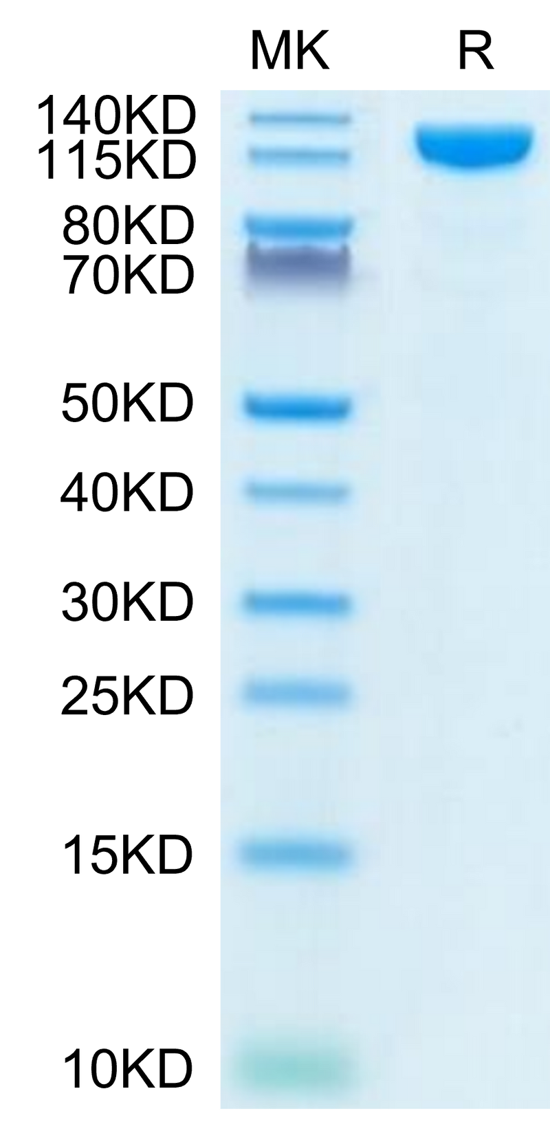 Human ACE2 on Tris-Bis PAGE under reduced condition. The purity is greater than 95%.Recombinant Human ACE2/ACEH Protein, Active