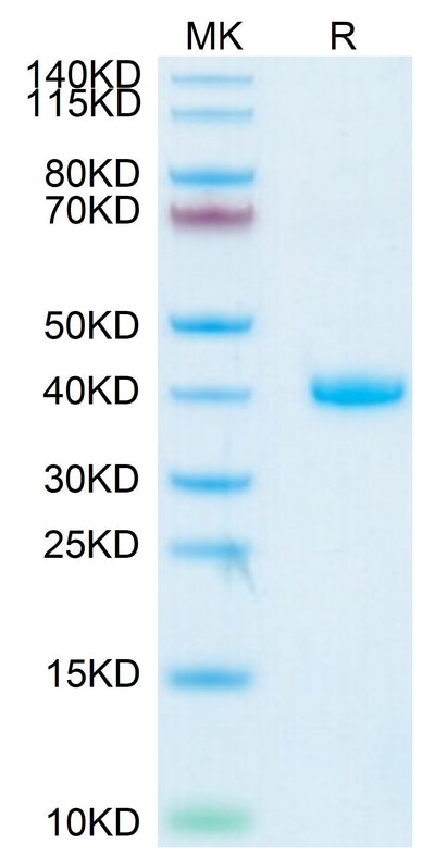 Human R spondin 1 on Tris-Bis PAGE under reduced condition. The purity is greater than 95%.Recombinant Human R spondin 1/RSPO1 Protein, Active