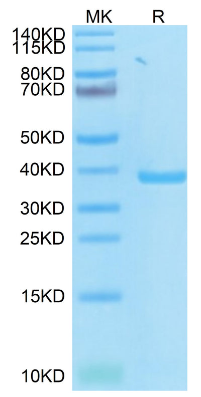 SARS-CoV-2 PLpro on Tris-Bis PAGE under reduced condition. The purity is greater than 95%.Recombinant SARS PLpro/papain-like protease Protein