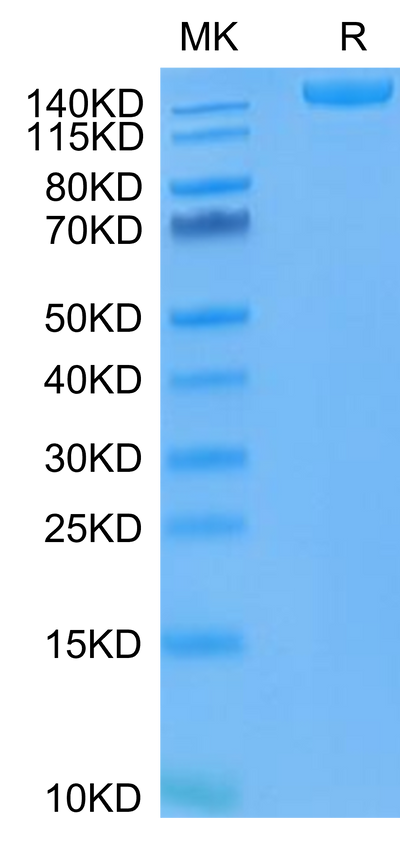 SARS-COV-2 Spike S Trimer (D614G) on Tris-Bis PAGE under reduced condition. The purity is greater than 95%.Recombinant SARS-COV-2 Spike S Trimer (D614G) Protein, Active