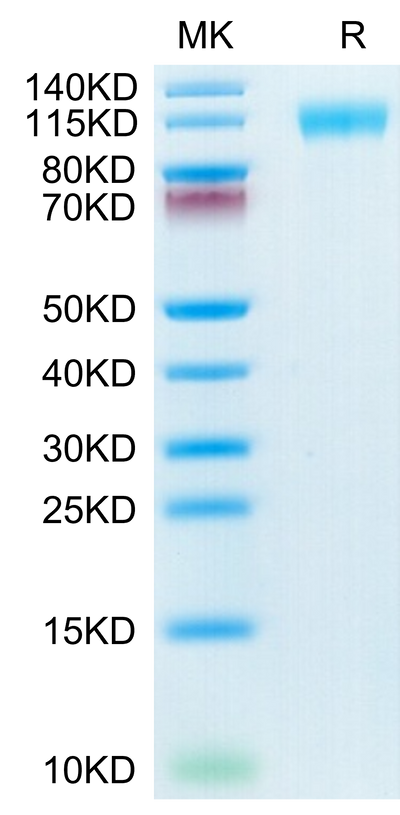 SARS-COV-2 Spike S1 (N501Y,K417N,E484K) on Tris-Bis PAGE under reduced condition. The purity is greater than 95%.Recombinant SARS-COV-2 Spike S1 (N501Y,K417N,E484K) Protein, Active