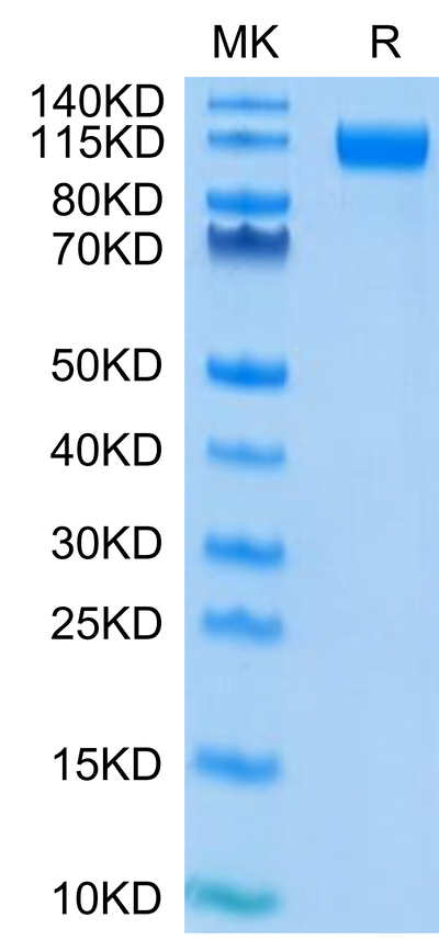 SARS-COV-2 Spike S1 (D614G) on Tris-Bis PAGE under reduced condition. The purity is greater than 95%.Recombinant SARS-COV-2 Spike S1 (D614G) Protein, Active