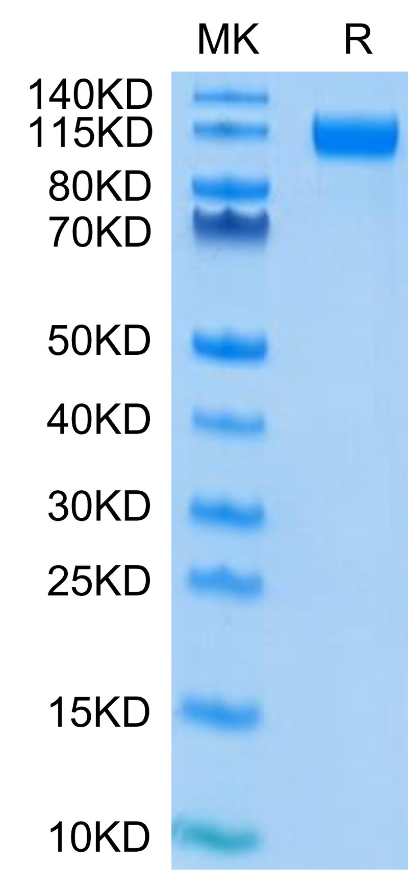 SARS-COV-2 Spike S1 (D614G) on Tris-Bis PAGE under reduced condition. The purity is greater than 95%.Recombinant SARS-COV-2 Spike S1 (D614G) Protein, Active