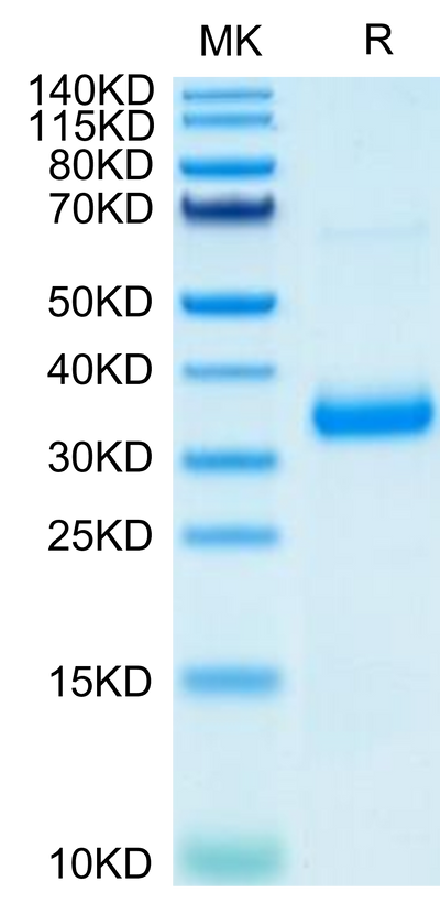 SARS-COV-2 Spike RBD (N501Y,K417N,E484K) on Tris-Bis PAGE under reduced condition. The purity is greater than 95%.Recombinant SARS-COV-2 Spike RBD (N501Y,K417N,E484K) Protein, Active