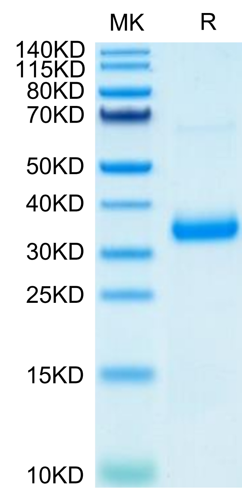 SARS-COV-2 Spike RBD (N501Y,K417N,E484K) on Tris-Bis PAGE under reduced condition. The purity is greater than 95%.Recombinant SARS-COV-2 Spike RBD (N501Y,K417N,E484K) Protein, Active