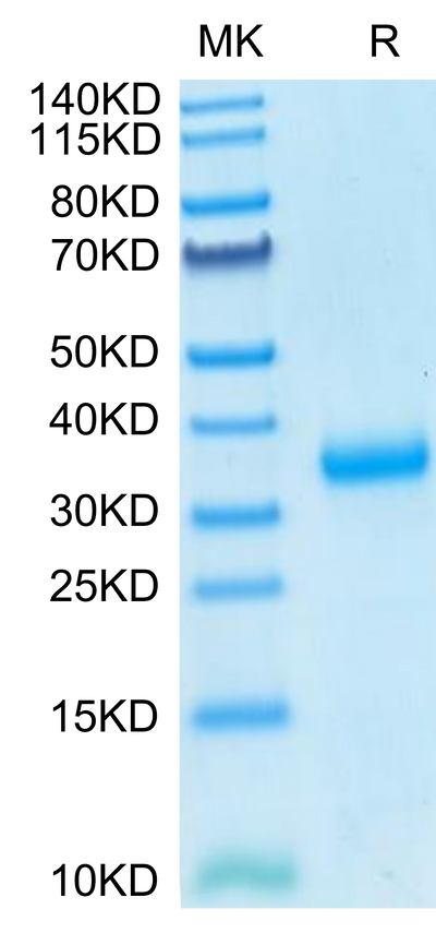SARS-COV-2 Spike RBD (N501Y) on Tris-Bis PAGE under reduced condition. The purity is greater than 95%.Recombinant SARS-COV-2 Spike RBD (N501Y) Protein, Active
