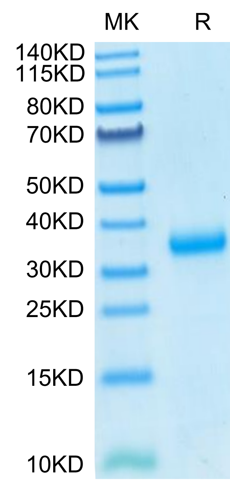 SARS-COV-2 Spike RBD (N501Y) on Tris-Bis PAGE under reduced condition. The purity is greater than 95%.Recombinant SARS-COV-2 Spike RBD (N501Y) Protein, Active