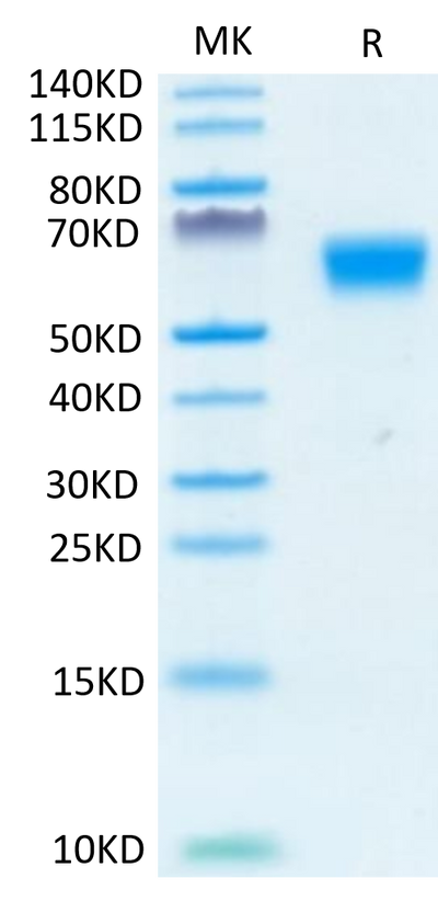 Human TGF-beta RII on Tris-Bis PAGE under reduced condition. The purity is greater than 95%.Recombinant Human TGF-beta RII/TGFBR2 Protein, Active