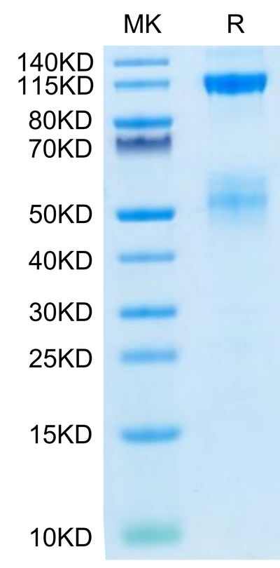 Biotinylated Human IGF1R on Tris-Bis PAGE under reduced condition. The purity is greater than 95%.Biotinylated Human IGF1R/CD221 Protein, Active