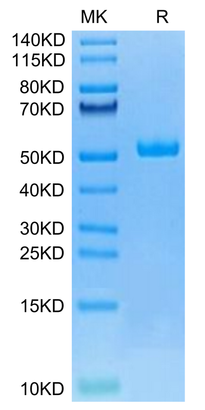 Canine HE4 on Tris-Bis PAGE under reduced condition. The purity is greater than 95%.Recombinant Canine HE4 Protein