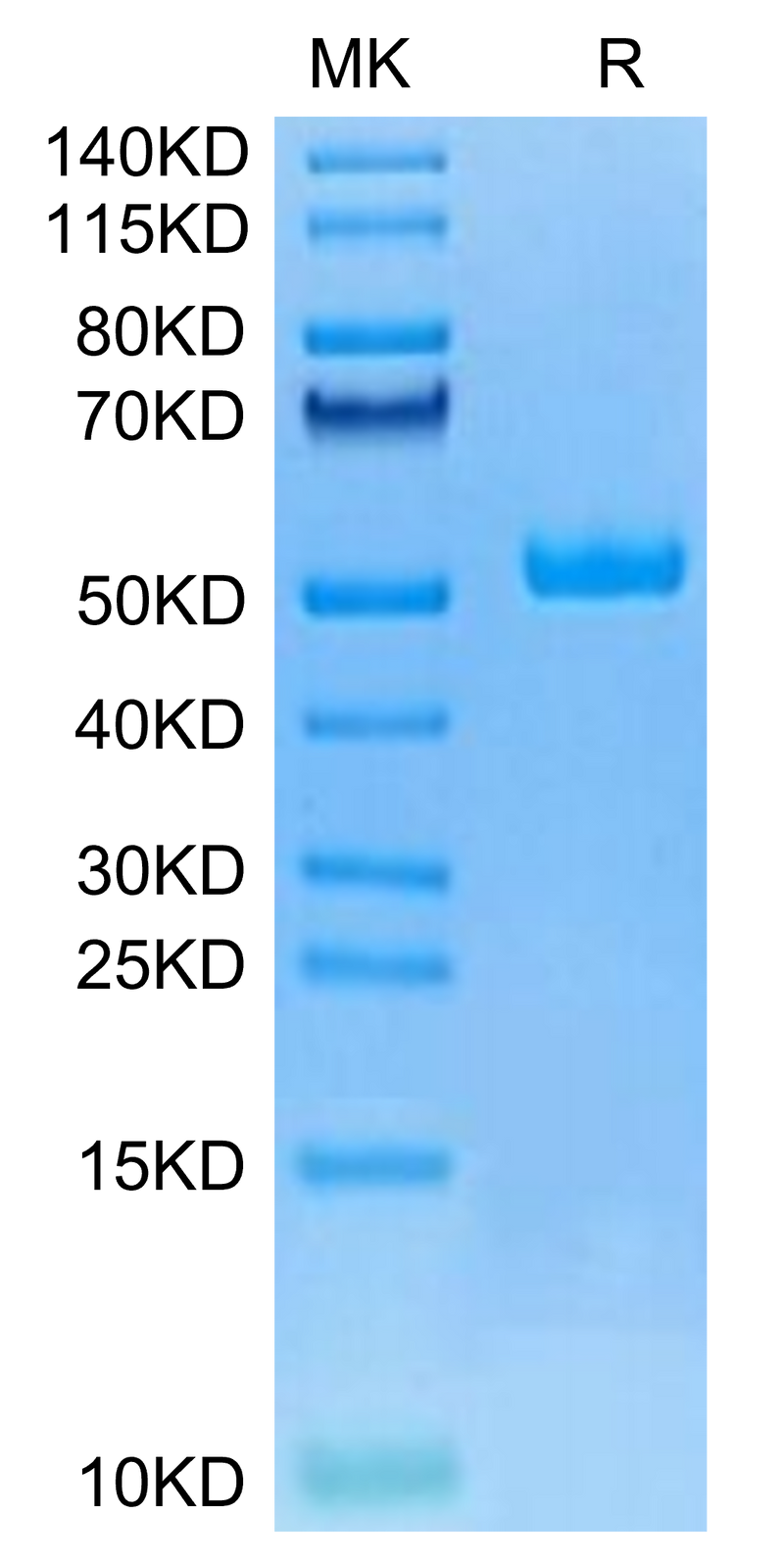 Canine HE4 on Tris-Bis PAGE under reduced condition. The purity is greater than 95%.Recombinant Canine HE4 Protein