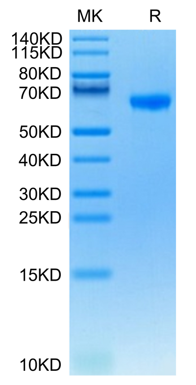 Human FCRL2 on Tris-Bis PAGE under reduced condition. The purity is greater than 95%.Recombinant Human FCRL2/IRTA4 Protein, Active